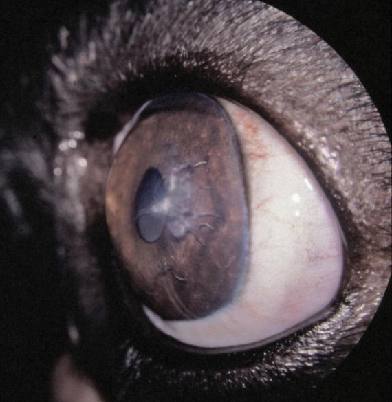 fordi strengene som strekker seg mellom linse, iris og baksiden av cornea forårsaker sekundærforandringer (fig 1.15). Figur 1.