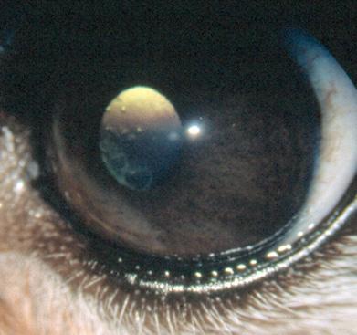 tydelig linseluksasjon på det ene øyet kan man ofte se samtidig fremfall av vitreus og/eller iridodonese i det andre øyet som tegn på subluksasjon (fig.11.15) Figur 11.