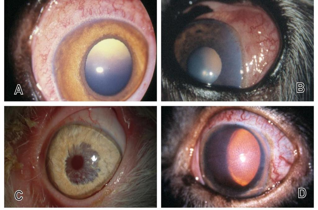 Iris er svullen, og det er ødem i cornea B: Episkleritt med hevelse og hyperemi i episklera.