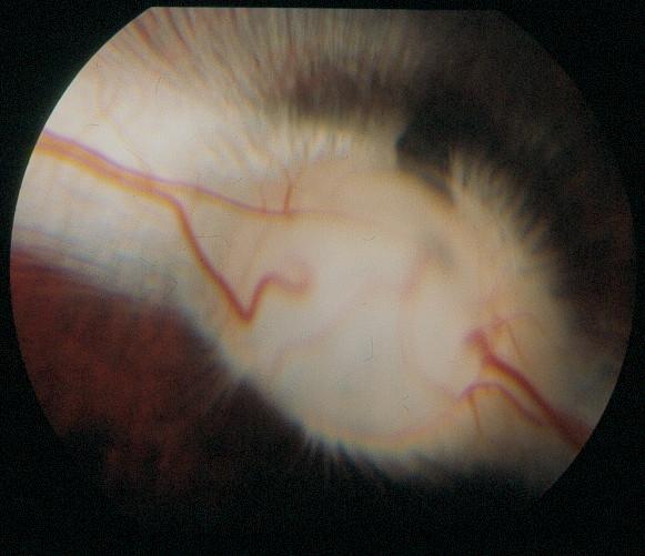 3.10.4.3 Drøvtygger Synspapillen hos drøvtygger er oval. Over papillen ligger en kraftig ring med store vener som strekker seg ut over retina. Tapetum er som regel blålig av farge (fig. 3.
