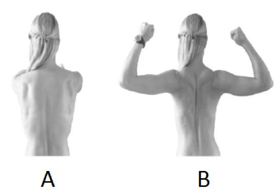 Seksjon 11 Flersvarsoppgave 7 Fra bilde A til B (se bilde nedenfor) beveger scapula seg horisontalt på thorax inn mot columna vertebralis.