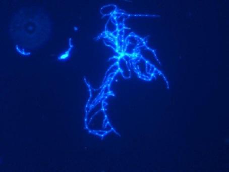 Antibiotikastyringsprogrammet 11.06.2018 Antibiotikautvalget Candida albicans i bronkialprøve. C.Andersen Forbruk av bredspektrede antibiotika 1.