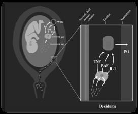 2000 Satin Aj et al. Obstet Gynecol.