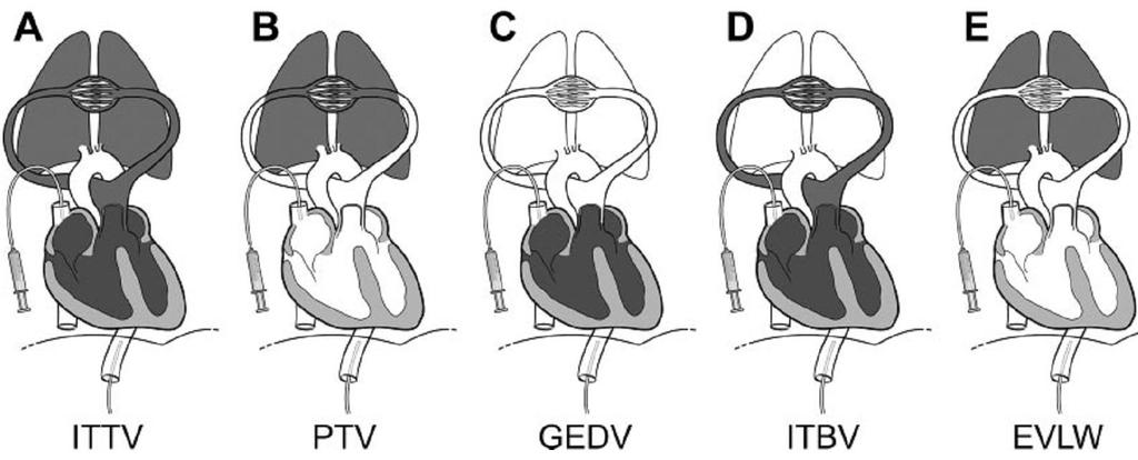 IntraThoracal Thermal Volume Pulmonary Thermal Volume Global End