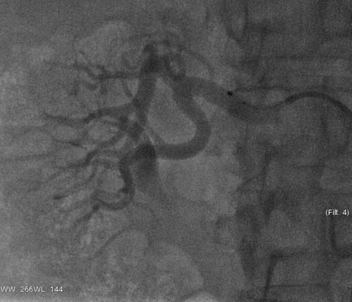 Metodeforslag i radiologi Strålevernets egnethetsvurdering: Viktig å skaffe oversikt over dosenivå, prosedyrer og