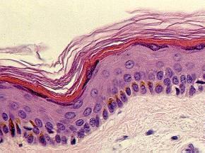 Skin effects Histologic view of the skin From Atlas de Histologia.... J. Boya EPIDERMIS DERMIS Basal stratum cells, highly mitotic, some of them with melanin, responsible of pigmentation.