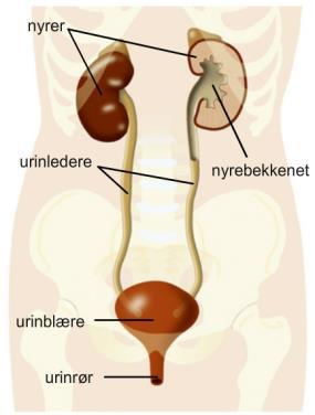 Urinveiene To nyrebekken To urinledere Urinblære Urinrør Glomerulonefritt - Side 121 Betennelse i nyrens karnøster (glomeruli).