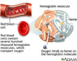 Hemoglobin og anemi Hemoglobin kan måles for å sjekke konsentrasjonen av hemoglobin i