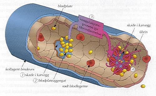 Koagulasjon (fibrintråder) Blod, Immunologi & Mikrobiologi Blodgrupper Ved blanding av blod fra to personer, vil erytrocyttene i de fleste tilfeller klumpe seg sammen (agglutinasjon)