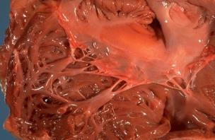 Aorta- og pulmonalklaffen Aortaklaffen: Mellom venstre ventrikkel og aorta.