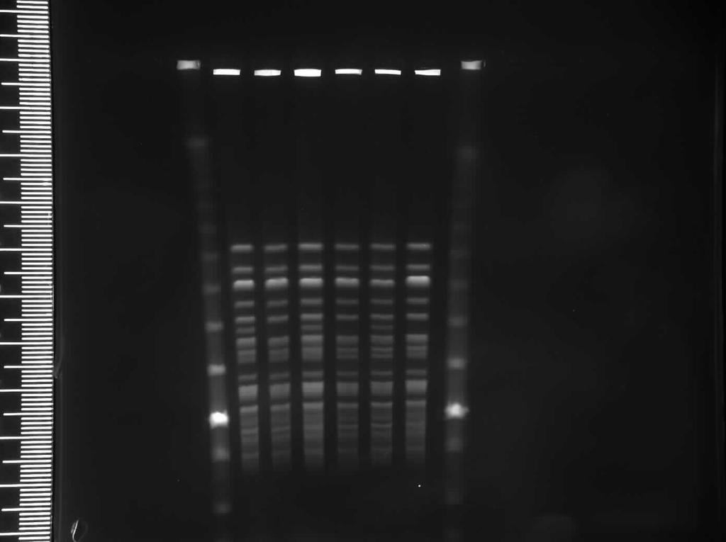 faecium VA MIC 1 mg/l (S) R S Ventilator-associated pneumonia Candida albicans