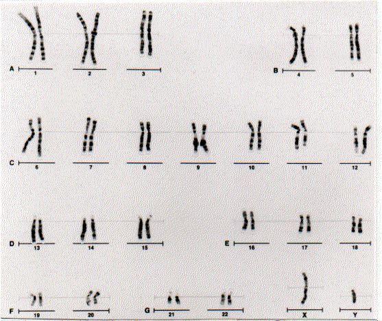 Kromosomene Kromosomer befinner seg i cellekjernen 46 kromosomer