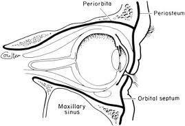 ORBITAL CELLULITT (Orbita-flegmone, postseptal cellulitt). Infeksjon bak orbitas fremre septum. Symptomer / anamnese: Rask utvikling. Dobbeltsyn. Smerter (ved øyebevegelser).