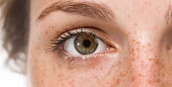 ØYEUNDERSØKELSE Eksterna: Blek, skadefri hud. Normal form på øyelokk uten blefaritt-funn. Normal motilitet, leie og stilling. Konjunktiva: Blek.