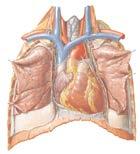 organtransplantasjon (DRG-