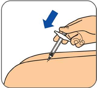 Trinn 4: Klem og hold forsiktig fast det rengjorte hudområdet med en hånd. Hold den ferdigfylte sprøyten i en 45 graders vinkel mot huden.