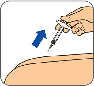 Trinn 6: Når sprøyten er tom, fjernes kanylen fra huden i samme vinkel som ved innsetting. Du må aldri sette kanylehetten på igjen.