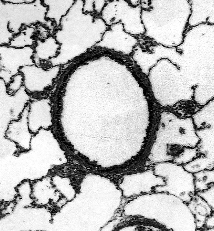 Parenchymal