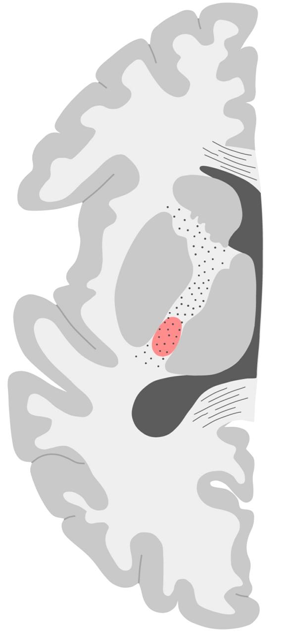 (caput) Splenium CC Ben B Arm C Thalamus D Arm Ben E Post.