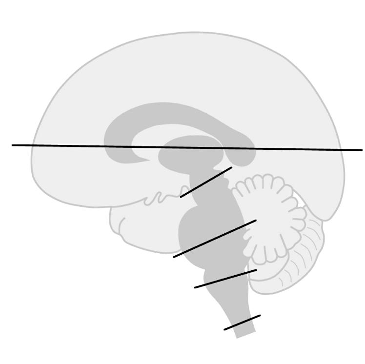 Pyramiden Arm Ben B C D MEDULLA SPINALIS Tractus corticospinalis lateralis