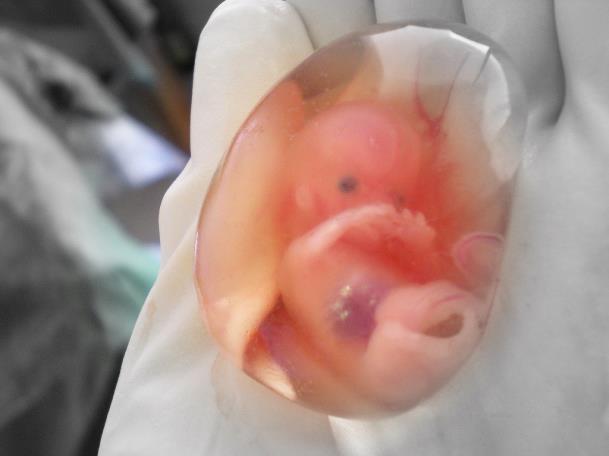 Graviditeten I livmorslimhinnen dannes livmorkaken og et lite foster.