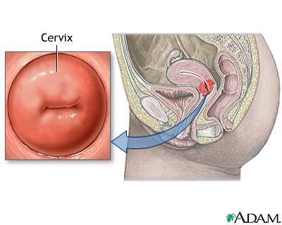 Livmoren Første del av livmor kalles livmorhalsen (Cervix).