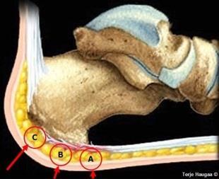 Ett praktisk eksempel (se meny 4 diagnose, behandlingsteori): Pasienten oppsøker deg til det du diagnostiserer til smerte under hælen (plantarfasciitt meny 4, smerter under foten valg 24).