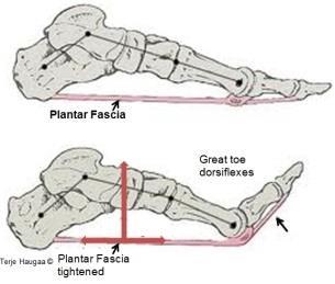 Det foreligger ofte nedsatt bevegelse i Os fibula (redusert dorsalfleksjon av fotbladet), kan også være nedsatt bevegelse i ekstensormusklene i hofta. 2. Windlassfunksjon/FHL.