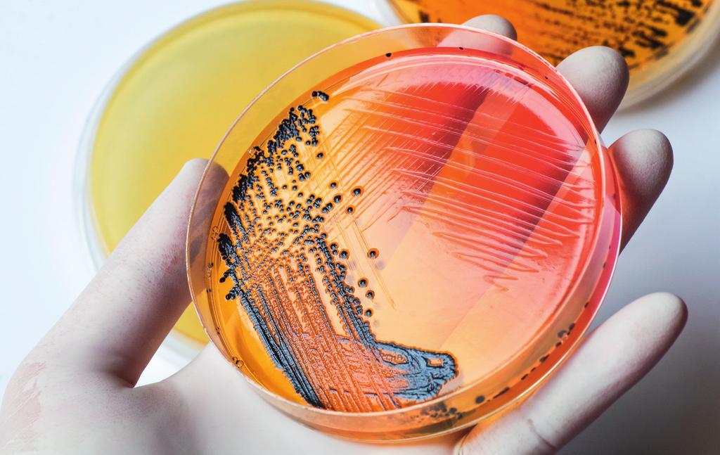 salmonellabakterien fra avføringsprøven og sammenligne det med arvestoffet fra andre salmonellabakterier, inkludert bakterien som vokste frem når du ble diagnostisert med Salmonella.