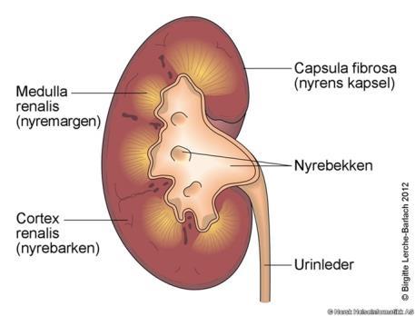 Glomerulonefritt, forts. Betennelsen utløses av immunologiske mekanismer, hvor antigen-antistoff-komplekser slår seg ned i karnøstet og derved bidrar til vevsskade.