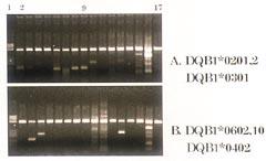 Brønn 2 17: 16 PCRreaksjoner. Brønn 1: DNA-størrelsesmarkør.a) Det øverste gelbildet er fra adenokarsinomet.b) Det nederste er fra normal tynntarmsslimhinne.