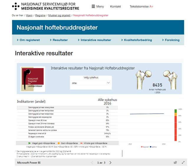 Nasjonalt hoftebruddregister første i Helse Vest med interaktive resultater