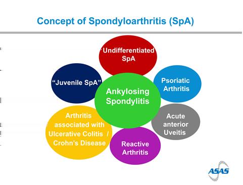 hele sykdomsbildet og til konseptet spondyloartritt.