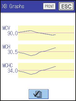 Trykk på [PRINT] for å skrive ut XB-grafen.