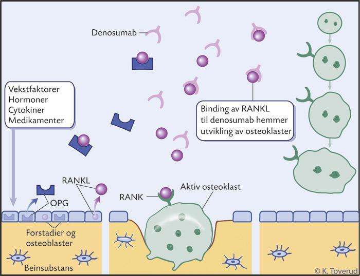 Figur 1 Denosumab - virkningsmekanisme.