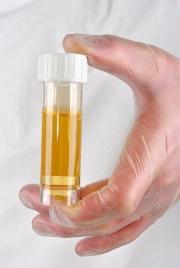 Etylglukuronid og etylsulfat (EtG og EtS) Etanolmetabolitter i urin Utskilles saktere enn alkohol Er sikre markører for etanolinntak siste