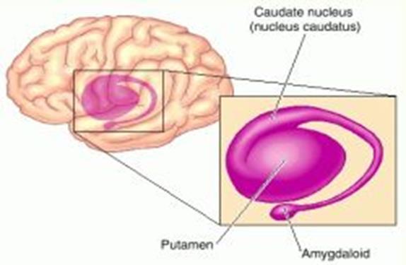 Mulige årsaker Primært skade i nucleus