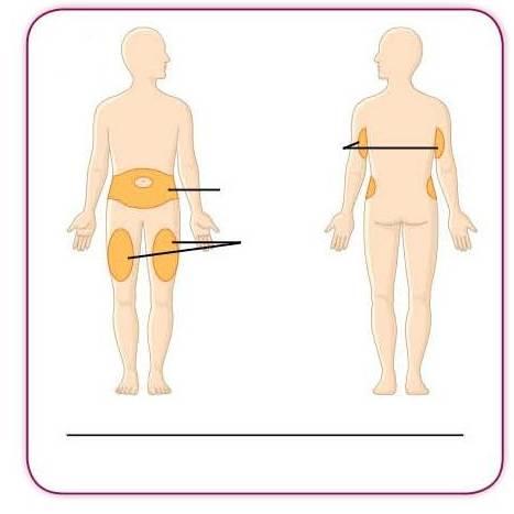 4d Baksiden av overarm Mage Lår Forside Bakside Områder på kroppen der injeksjon kan