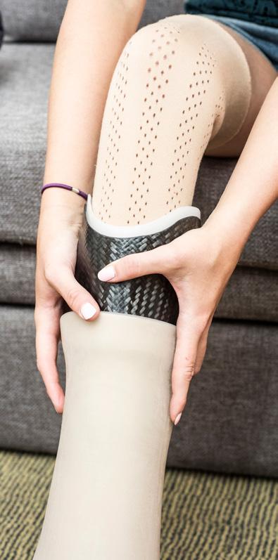 Innovasjon i aksjon: En ny retning innen silikonlinerteknologi Optimal kontroll av en protese er avhengig av en komfortabel og sikker tilkobling mellom protesen og hylsen.