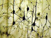 Nevrale nett Hjerneområder Enkelt nevron - egenskaper Atferd Gen og proteinuttrykk Synapser Nevrotransmittere 7 Nervecelle Nettverk av nerveceller Hjernen med sine: 100