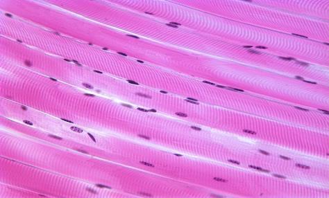 Skjelettmuskelcellen Skjelettmuskelcelle = muskelfiber. Langstrake, sylinderformete celler som inneholder flere cellekjerner. clcpages.clcillinois.