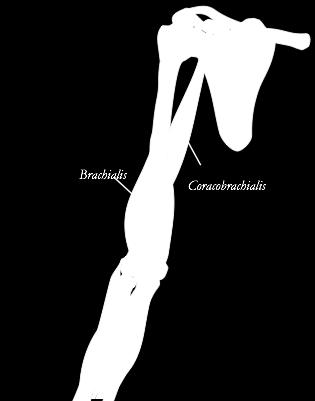 M. Coracobrachialis Utspring: utskudd i framkant av skulderbladet Feste: overarmen Brachialis Coracobrachialis Funksjon: fleksjon og horisontaladduksjon (innoverføring av arm i horisontalplan). 51 M.