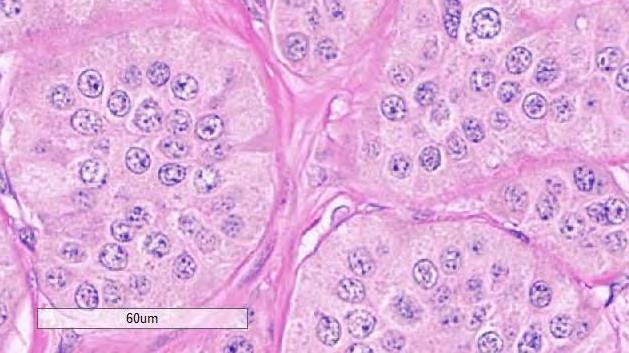 cytoplasma (gjerne granulert) og typisk salt og