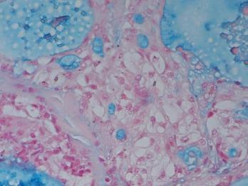 Hellquist/Skalova: Histopathology of the salivary glands 2014
