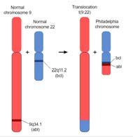 Immunterapi mot cancer Humoral immunitet Monoklonale antistoffer Cellemediert BM-transplantasjon «Graft vs leukemi effekt» Kreftvaksiner T-celle terapi 33 Cancerassosierte antigener er «target» for