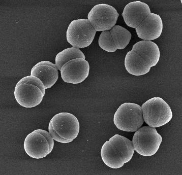 1% av tarmmikrobiota hos mennesker Økende viktighet som sykehuspatogen Overlever i ekstreme miljøer ph, salt, temperaturer, kjemiske desinfeksjonsmidler > 9 dager på