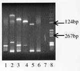 Nederst) Autoradiogram etter at gelen er blottet og hybridisert med DIG-merket probe spesifikkk for bcl-2-genet. Samme rekkefølge som ovenfor.