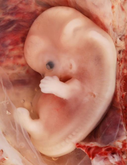 Embryo 7 uker