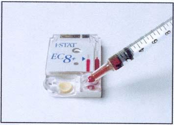 istat blood analysis glucose, urea, ph,