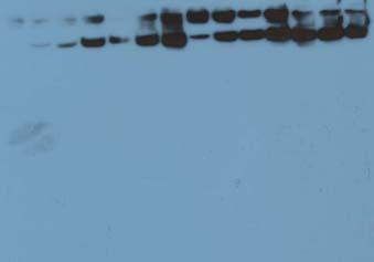 36 kda A Figur 25 SDS-PAGE (7,5 % gel) (figur A) og westernblotting (figur B) av myofibrillproteiner ekstrahert under